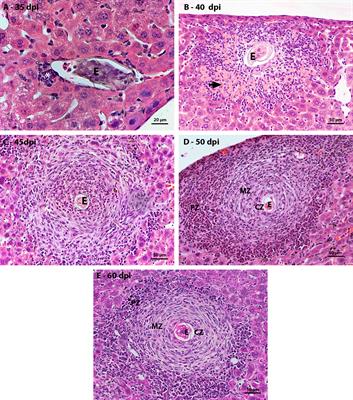 The hepatic extramedullary hematopoiesis during experimental murine Schistosomiasis mansoni